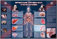 Электрифицированный стенд "Вредные привычки: алкоголизм" - «globural.ru» - Верхняя Пышма